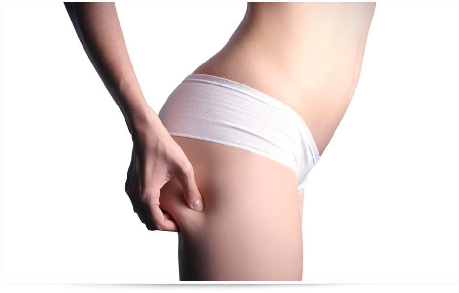Les traitements efficaces contre la cellulite aqueuse